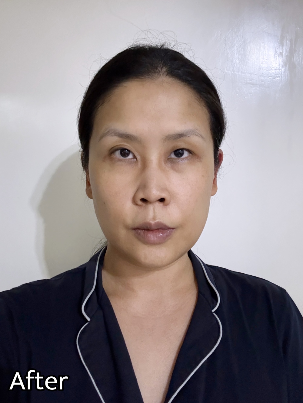 麗珠蘭Rejuran深層保濕面膜