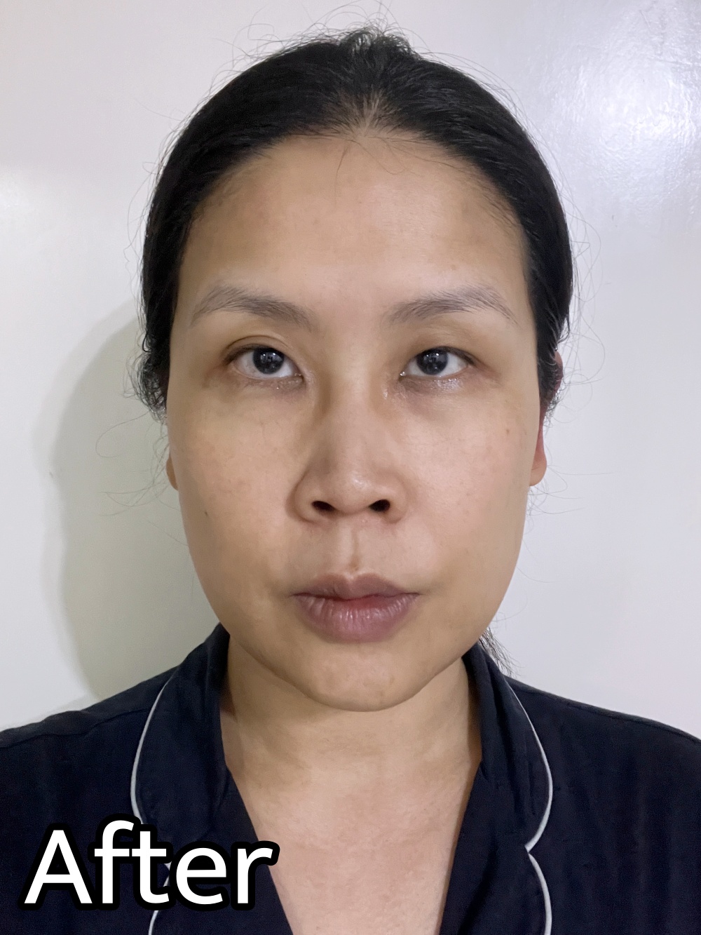 韓國Vaseline凡士林高效保濕面膜