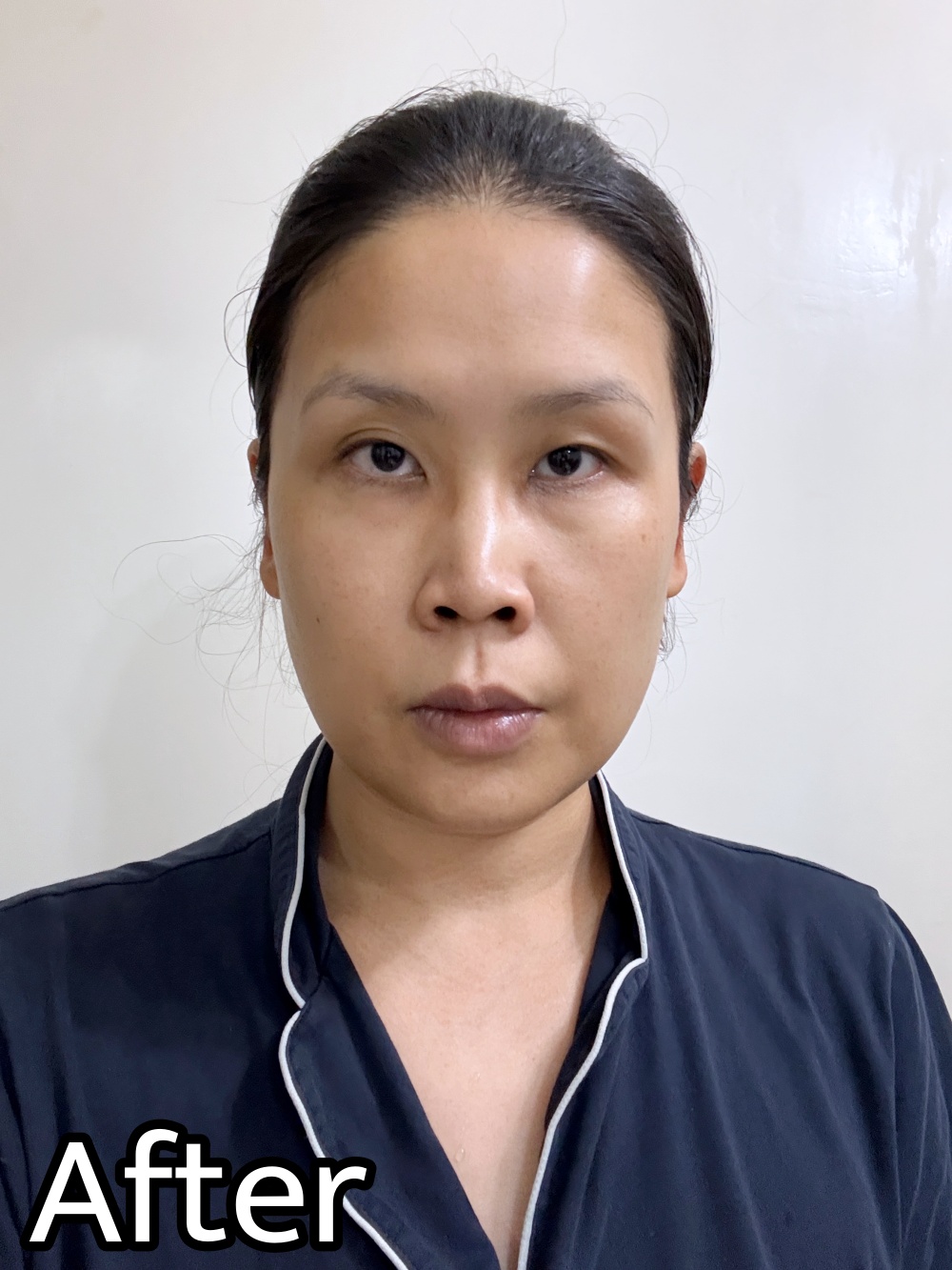 希臘Apivita蘆薈保濕清爽面膜