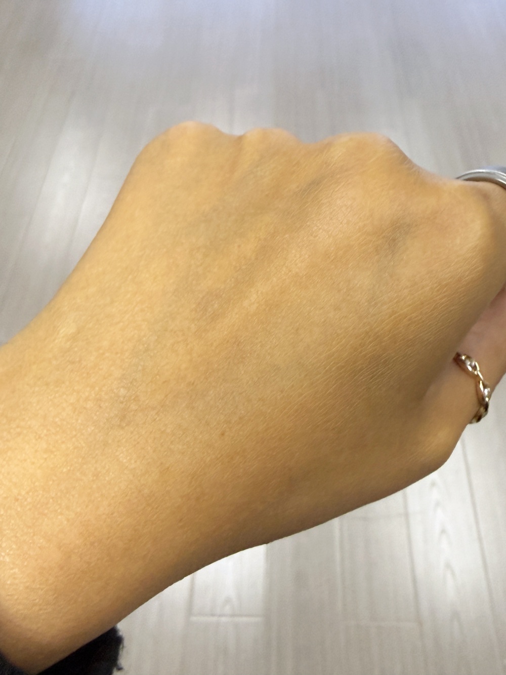 敏感肌實測後 (After)：連續使用 Wellmaxx 安瓶 3 天後，紅腫及痕癢明顯消退，皮膚回復平滑水潤。