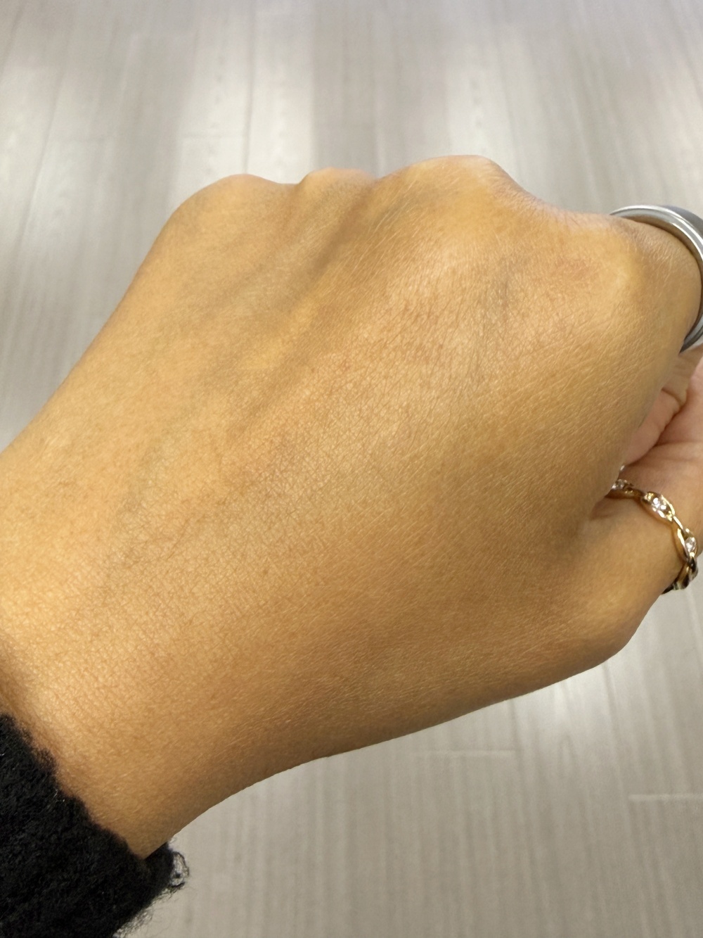 敏感肌實測前 (Before)：手部皮膚出現泛紅、乾燥及痕癢症狀，準備使用 Wellmaxx 無香料安瓶進行急救。