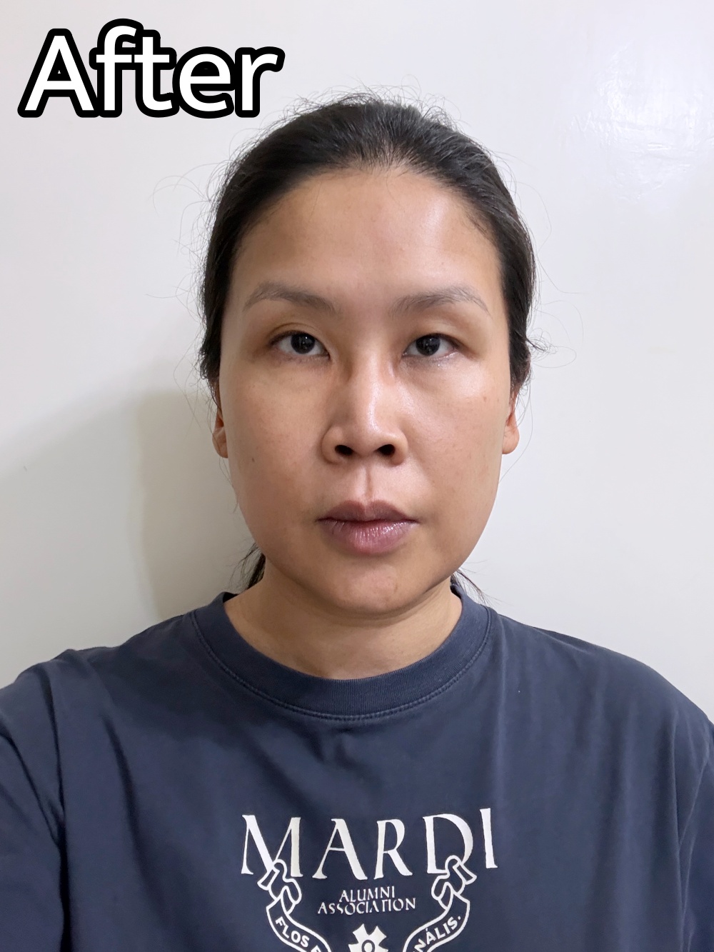 Hakme 實測 Minon Amino Moist 亮膚乳液面膜敷後即時提亮效果，拆解美白續航力不足的致命缺點
