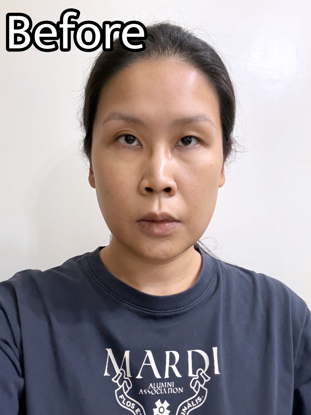 Hakme 使用 Minon Amino Moist 亮膚乳液面膜前素顏真實紀錄，針對敏感肌面色暗沉黃氣問題